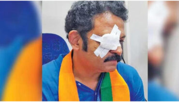 ‘കോർണിയയിൽ മുറിവ്, ബോധപൂർവ്വമായ ആക്രമണം’; കണ്ണിന് പരിക്കേറ്റതിൽ ആരോപണവുമായി എൻഡിഎ സ്ഥാനാർഥി കൃഷ്ണകുമാർ
