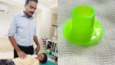 ഒരു വർഷമായി അസഹ്യമായ തൊണ്ടവേദന; പുറത്തെടുത്തത് കളിപ്പാട്ടത്തിലെ പ്ലാസ്റ്റിക്