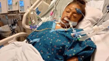 പിറ്റ് ബുൾ ആക്രമണത്തിൽ യുവതിക്ക് കൈകാലുകൾ നഷ്ടപ്പെട്ടു, ദാരുണ സംഭവം യുഎസിലെ ഒക്ലഹോമയിൽ