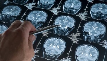 യുകെയിൽ നാലുവയസ്സുകാരന് ചൈൽഡ്ഹുഡ് ഡിമെൻഷ്യ സ്ഥിരീകരിച്ചു; ബിബിസിയോട് വെളിപ്പെടുത്തി അമ്മ