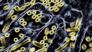 വാഷിങ്ടണിൽ മനുഷ്യരിലെ ആദ്യത്തെ പക്ഷിപ്പനി മരണം റിപ്പോർട്ട് ചെയ്‌തു; പൊതുജനാരോഗ്യത്തിന് ഭീഷണി ഇല്ലെന്ന് സിഡിസി