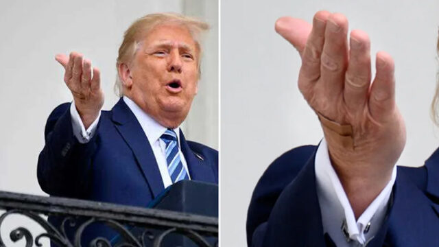 ഇടയ്ക്കിടെ ഹസ്തദാനം നടത്തേണ്ടിവരുന്നതുകൊണ്ട് സംഭവിച്ചതാണ്, ട്രംപിൻ്റെ കയ്യിലെ പാട് ആരോഗ്യ പ്രശ്നമല്ലെന്ന് വൈറ്റ്ഹൌസ് പ്രസ് സെക്രട്ടറി