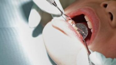 2027 ആകുമ്പോഴേക്കും മെർക്കുറി അടങ്ങിയ ഡെന്റൽ ഫില്ലിംഗുകളുടെ ഉപയോഗം നിർത്തലാക്കാൻ ഇന്ത്യൻ ഹെൽത്ത് സർവീസ് തീരുമാനം