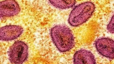 ഇന്ത്യയിലും യുകെയിലും രണ്ട് പുതിയ എംപോക്സ് വൈറസ് വകഭേദം സ്ഥിരീകരിച്ച് ലോകാരോഗ്യ സംഘടന