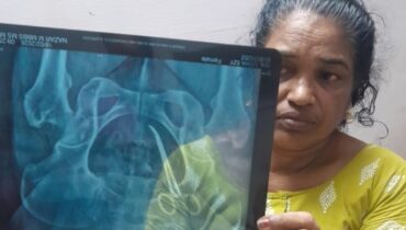 ശസ്ത്രക്രിയക്കിടെ വയറ്റിൽ കത്രിക മറന്നുവെച്ചു, 5 വർഷങ്ങൾക്ക് ശേഷം എംആർഐ സ്കാനിംഗിൽ കണ്ടെത്തി; ആലപ്പുഴ മെഡിക്കൽ കോളേജിൽ ഗുരുതര ചികിത്സാ പിഴവ്